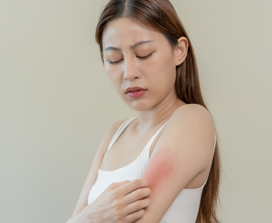Atopy: The common thread behind allergies, asthma, and eczema