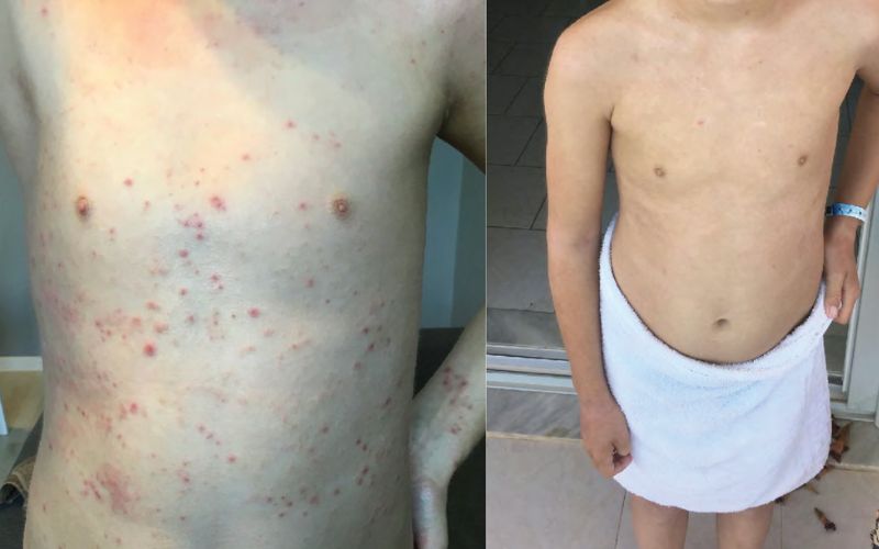 Allergoff Atopy Skin Barrier Emulsion for Gentle Face and Body Cleansing 250mL image 4