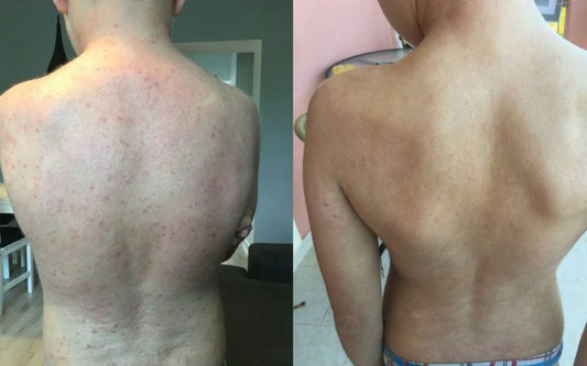 Allergoff Atopy Skin Barrier Emulsion for Gentle Face and Body Cleansing 250mL image 2