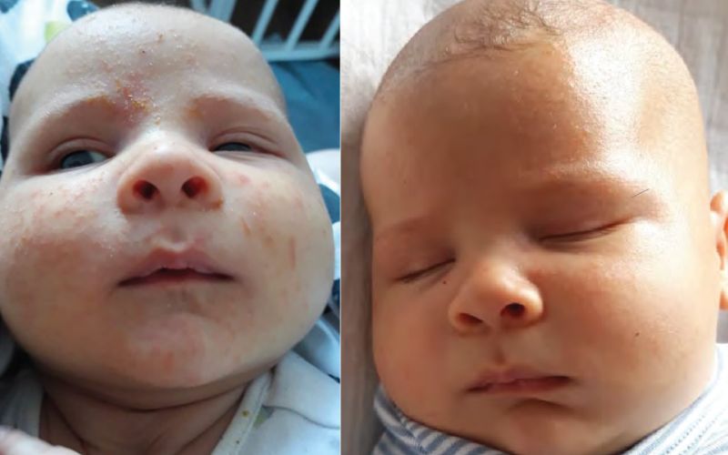 Allergoff Atopy Skin Barrier Emulsion for Gentle Face and Body Cleansing 250mL image 3