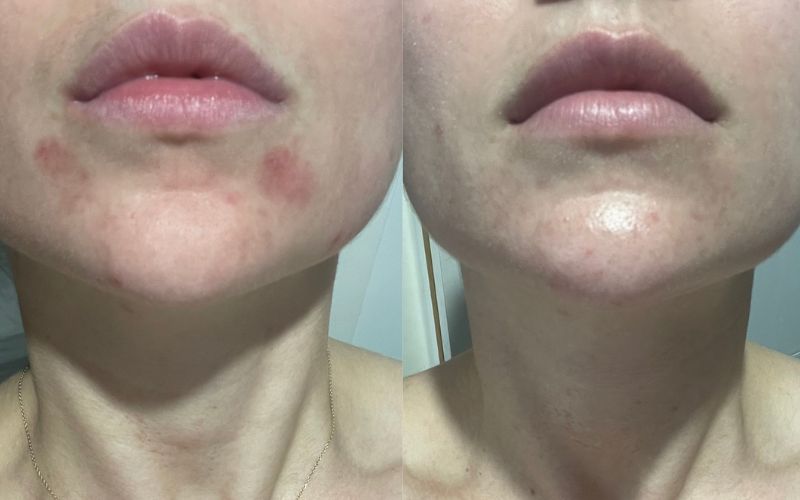 Allergoff Atopy Skin Barrier Emulsion for Gentle Face and Body Cleansing 250mL image 5