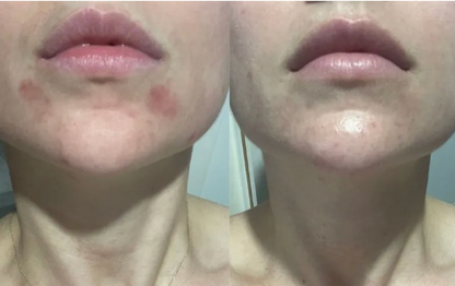 Allergoff Atopy Skin Barrier Emulsion for Gentle Face and Body Cleansing 250mL